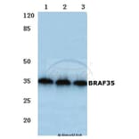 Anti-BRAF35 (T29) Antibody from Bioworld Technology (BS2157) - Antibodies.com