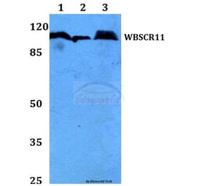Anti-WBSCR11 (K94) Antibody from Bioworld Technology (BS2161) - Antibodies.com