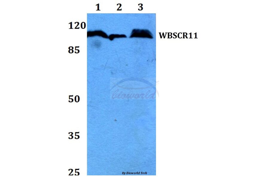 Anti-WBSCR11 (K94) Antibody from Bioworld Technology (BS2161) - Antibodies.com