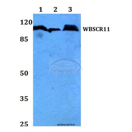 Anti-WBSCR11 (K94) Antibody from Bioworld Technology (BS2161) - Antibodies.com