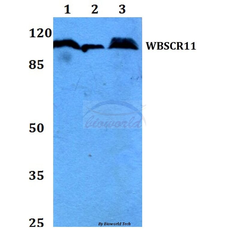 Anti-WBSCR11 (K94) Antibody from Bioworld Technology (BS2161) - Antibodies.com