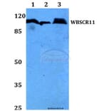 Anti-WBSCR11 (K94) Antibody from Bioworld Technology (BS2161) - Antibodies.com