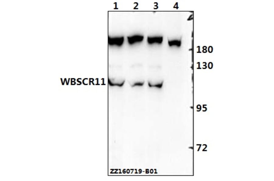 Anti-WBSCR11 (K94) Antibody from Bioworld Technology (BS2161) - Antibodies.com