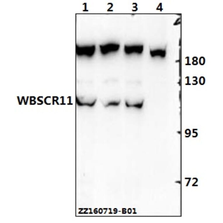 Anti-WBSCR11 (K94) Antibody from Bioworld Technology (BS2161) - Antibodies.com