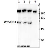 Anti-WBSCR11 (K94) Antibody from Bioworld Technology (BS2161) - Antibodies.com