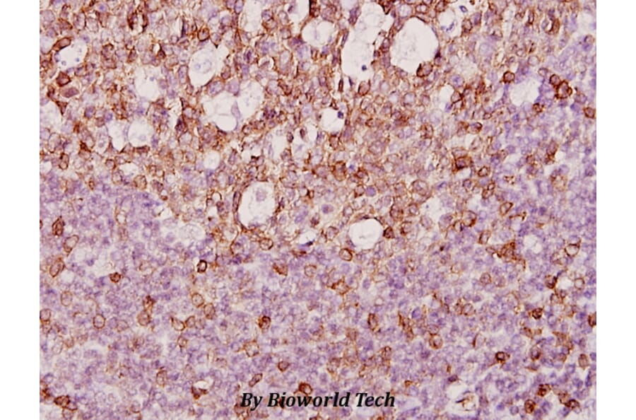 Anti-RAGE (Q286) Antibody from Bioworld Technology (BS2165) - Antibodies.com