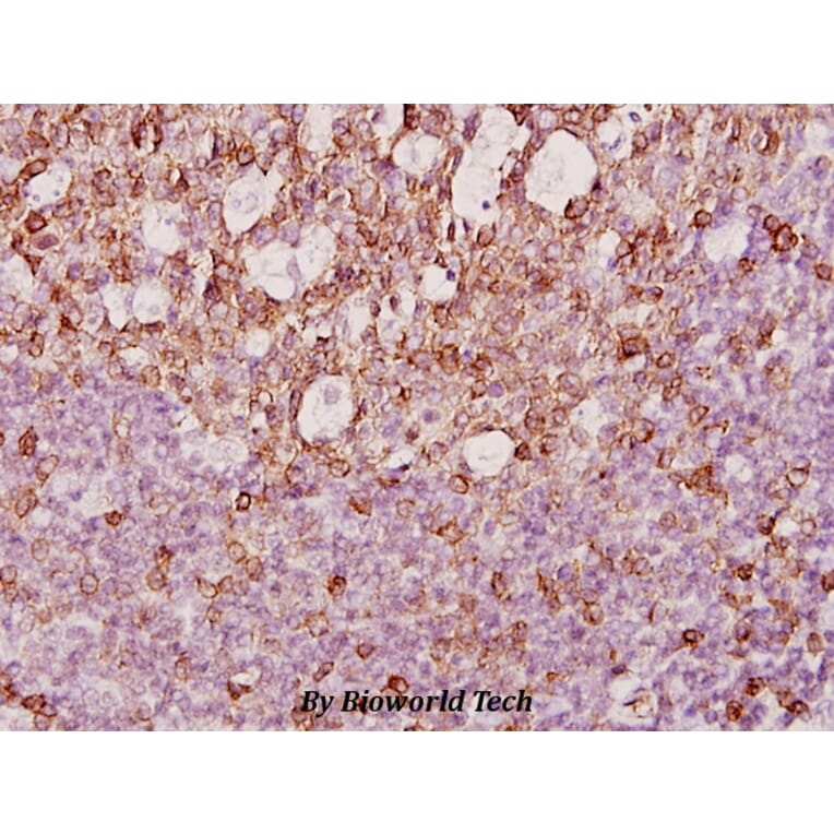 Anti-RAGE (Q286) Antibody from Bioworld Technology (BS2165) - Antibodies.com