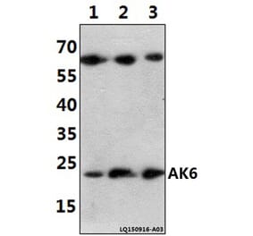 Anti-AK6 (G35) Antibody from Bioworld Technology (BS2171) - Antibodies.com