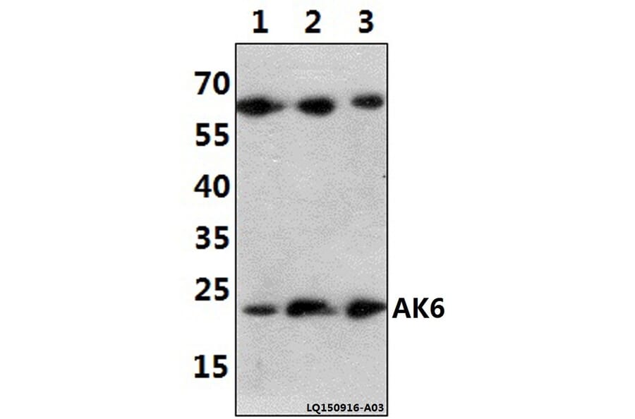 Anti-AK6 (G35) Antibody from Bioworld Technology (BS2171) - Antibodies.com