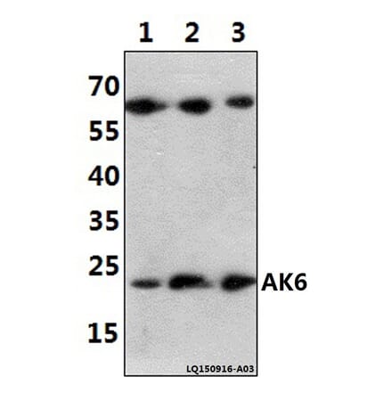 Anti-AK6 (G35) Antibody from Bioworld Technology (BS2171) - Antibodies.com