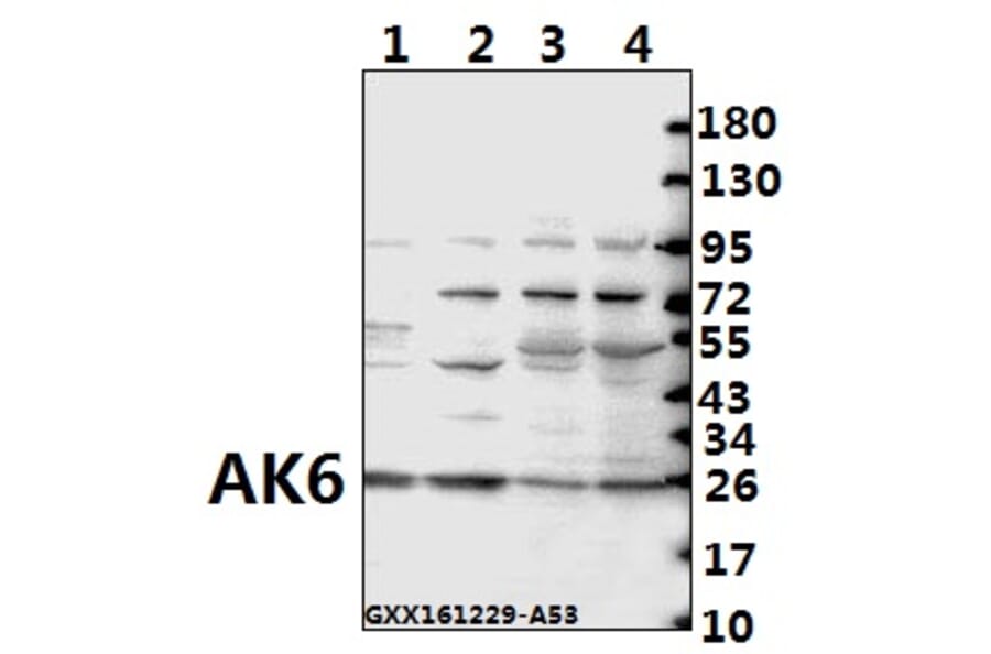 Anti-AK6 (G35) Antibody from Bioworld Technology (BS2171) - Antibodies.com