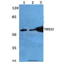 Anti-TBX22 (A30) Antibody from Bioworld Technology (BS2173) - Antibodies.com