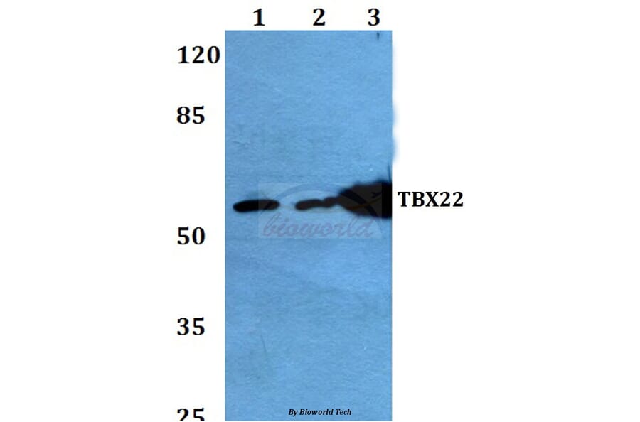 Anti-TBX22 (A30) Antibody from Bioworld Technology (BS2173) - Antibodies.com