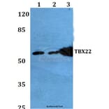 Anti-TBX22 (A30) Antibody from Bioworld Technology (BS2173) - Antibodies.com