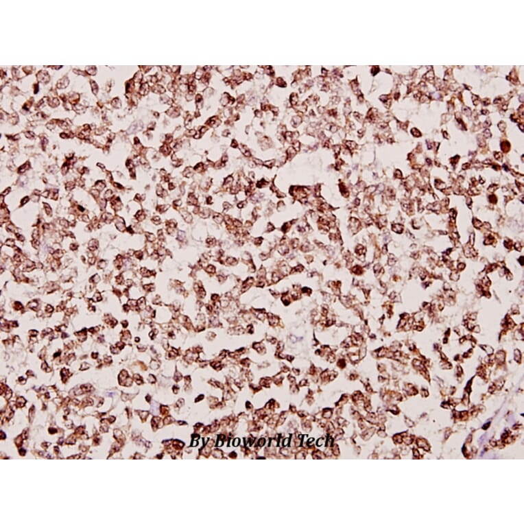Anti-PAF65α (Q53) Antibody from Bioworld Technology (BS2175) - Antibodies.com