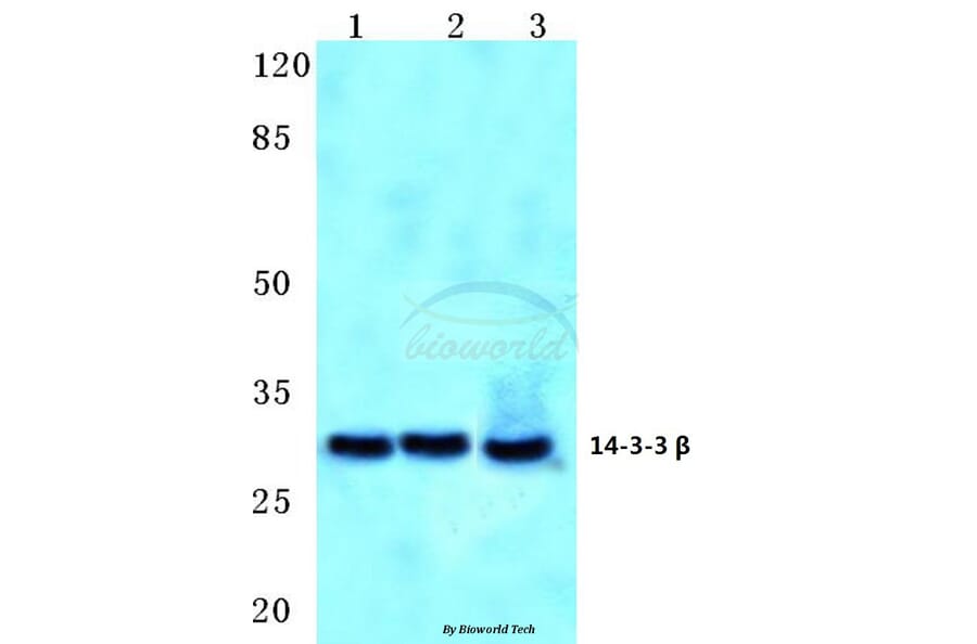 Anti-14-3-3 β (Q69) Antibody from Bioworld Technology (BS2176) - Antibodies.com