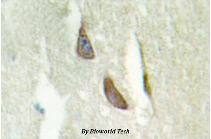 Anti-14-3-3 β (Q69) Antibody from Bioworld Technology (BS2176) - Antibodies.com