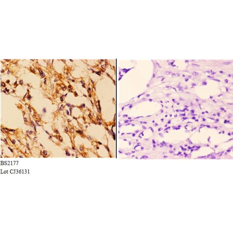Anti-14-3-3 ε (D238) Antibody from Bioworld Technology (BS2177) - Antibodies.com