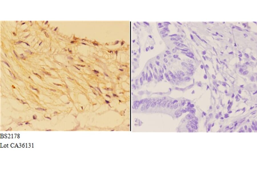 Anti-14-3-3 σ (E66) Antibody from Bioworld Technology (BS2178) - Antibodies.com