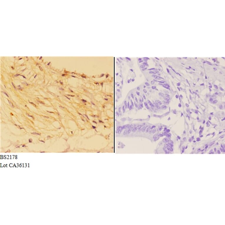 Anti-14-3-3 σ (E66) Antibody from Bioworld Technology (BS2178) - Antibodies.com