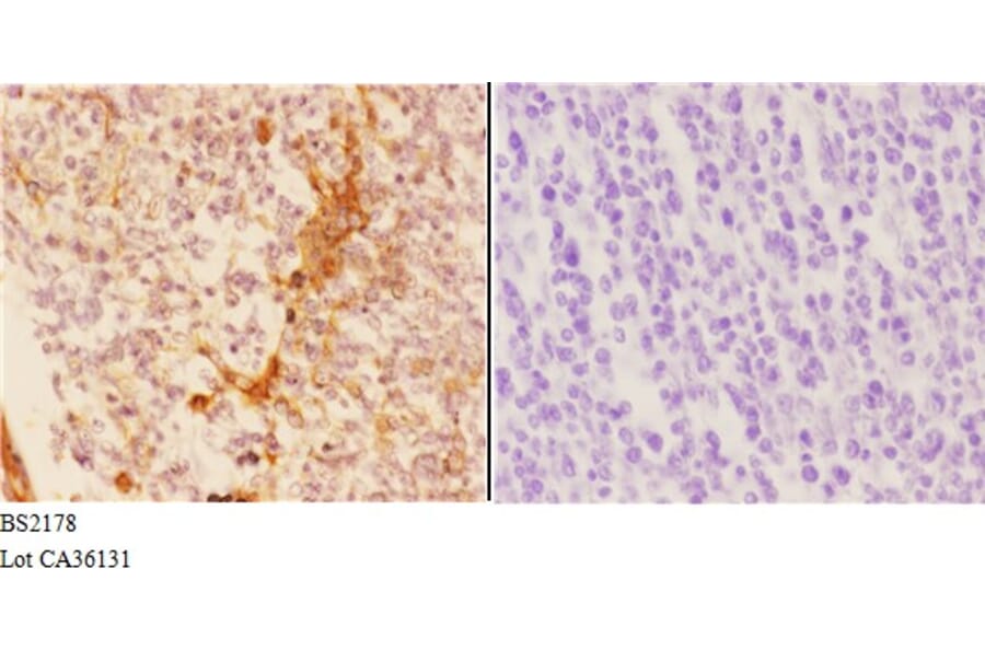 Anti-14-3-3 σ (E66) Antibody from Bioworld Technology (BS2178) - Antibodies.com