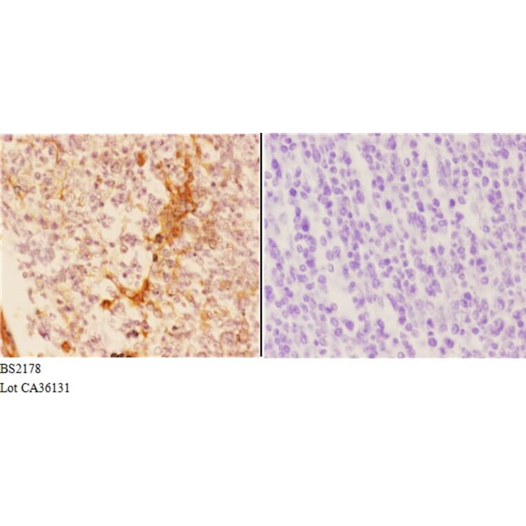 Anti-14-3-3 σ (E66) Antibody from Bioworld Technology (BS2178) - Antibodies.com