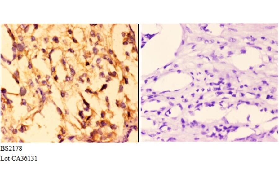 Anti-14-3-3 σ (E66) Antibody from Bioworld Technology (BS2178) - Antibodies.com