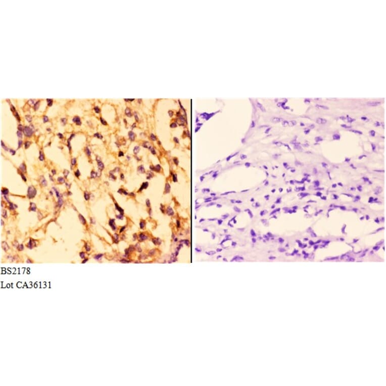 Anti-14-3-3 σ (E66) Antibody from Bioworld Technology (BS2178) - Antibodies.com