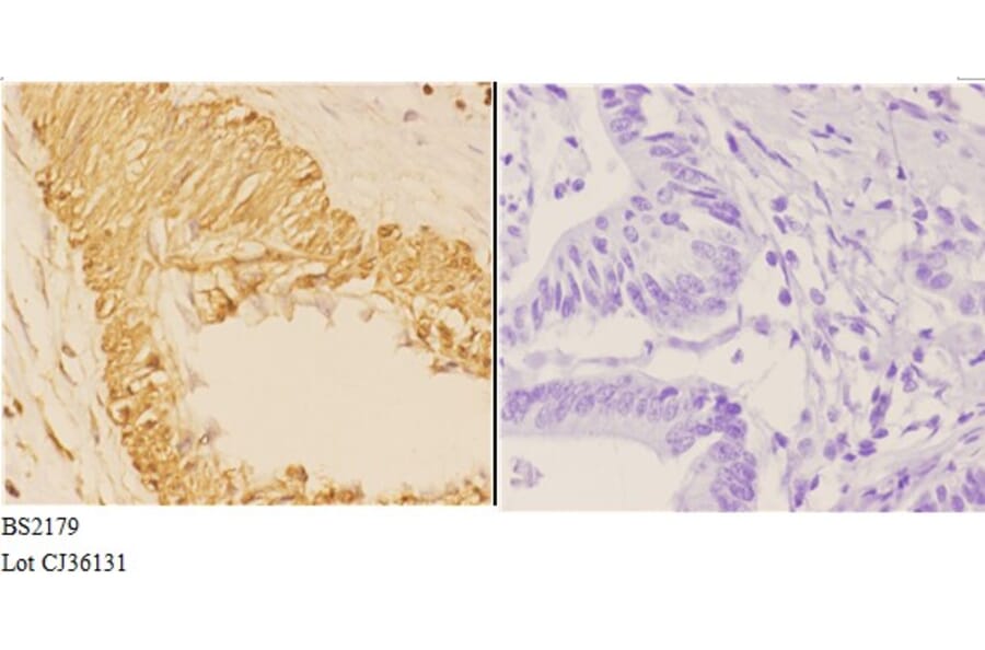 Anti-14-3-3 θ (Q67) Antibody from Bioworld Technology (BS2179) - Antibodies.com