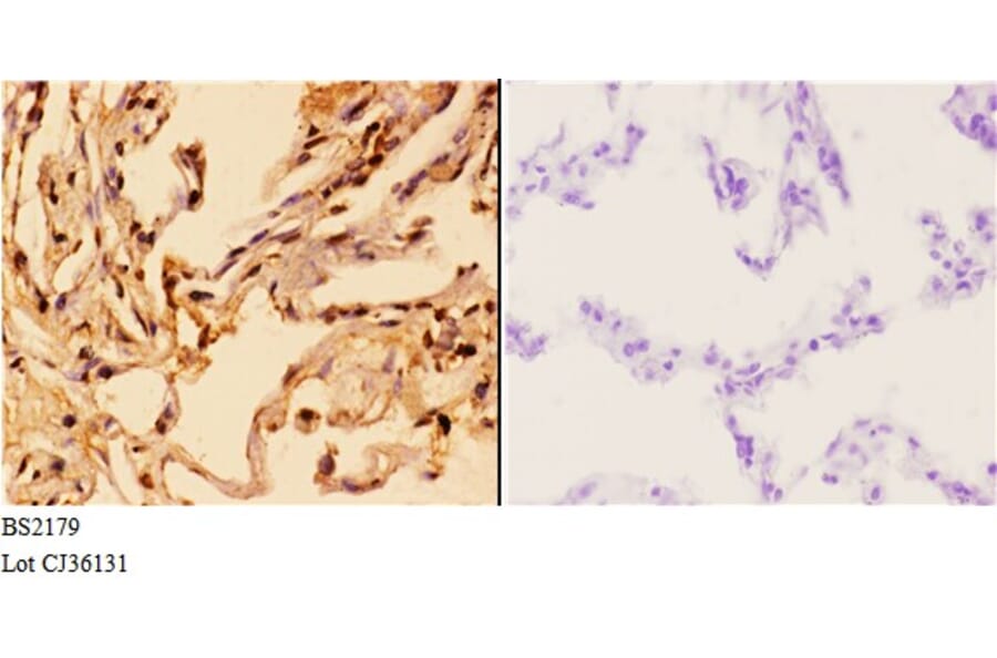 Anti-14-3-3 θ (Q67) Antibody from Bioworld Technology (BS2179) - Antibodies.com