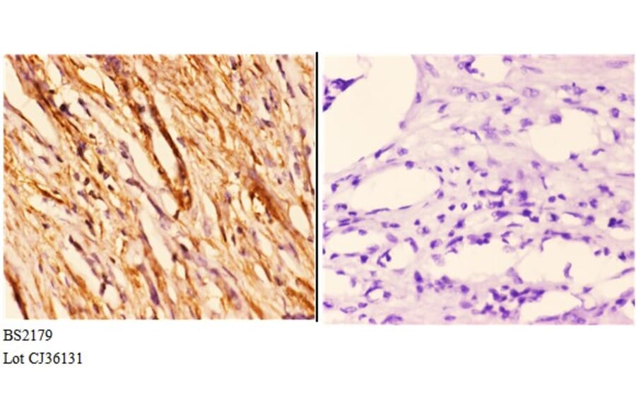 Anti-14-3-3 θ (Q67) Antibody from Bioworld Technology (BS2179) - Antibodies.com
