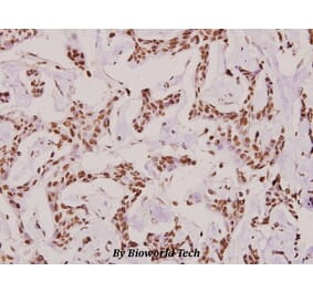 Anti-COL6A2 (Y711) Antibody from Bioworld Technology (BS2181) - Antibodies.com