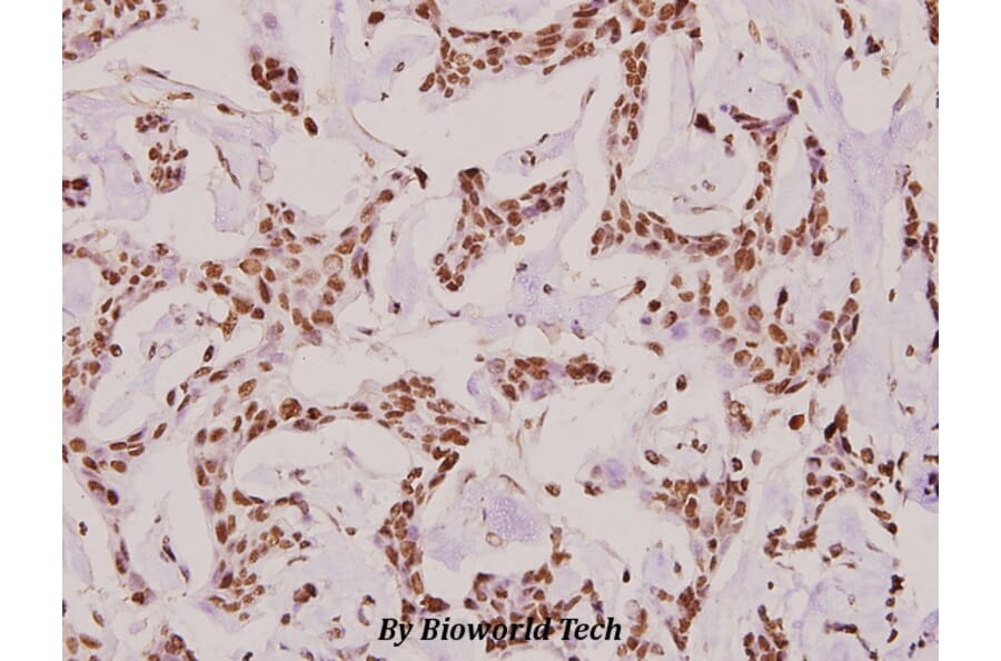 Anti-COL6A2 (Y711) Antibody from Bioworld Technology (BS2181) - Antibodies.com