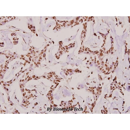 Anti-COL6A2 (Y711) Antibody from Bioworld Technology (BS2181) - Antibodies.com