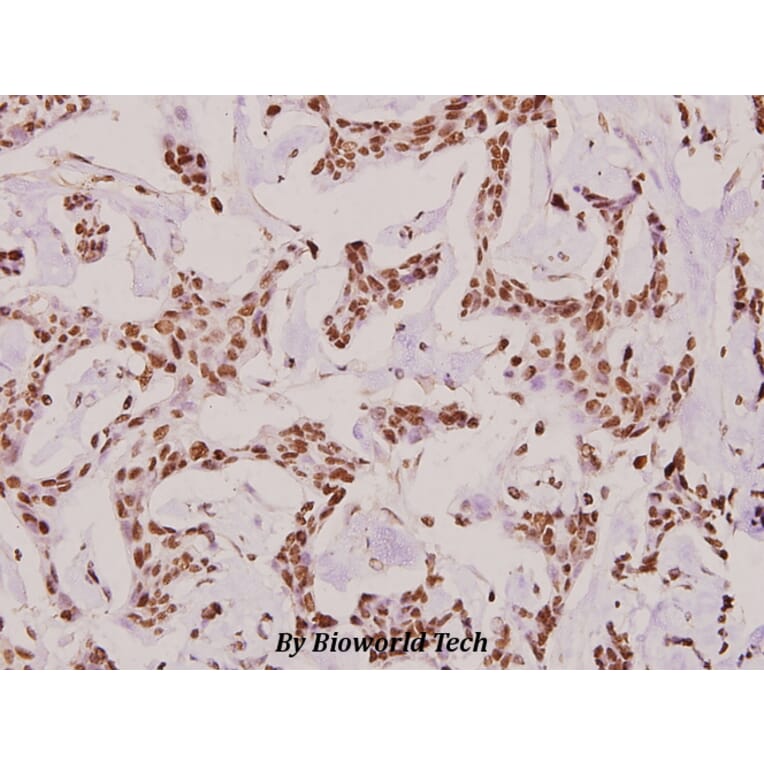 Anti-COL6A2 (Y711) Antibody from Bioworld Technology (BS2181) - Antibodies.com
