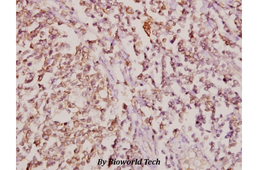 Anti-COL11A1 (G610) Antibody from Bioworld Technology (BS2182) - Antibodies.com