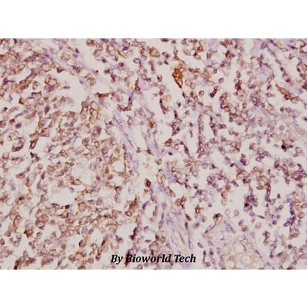 Anti-COL11A1 (G610) Antibody from Bioworld Technology (BS2182) - Antibodies.com