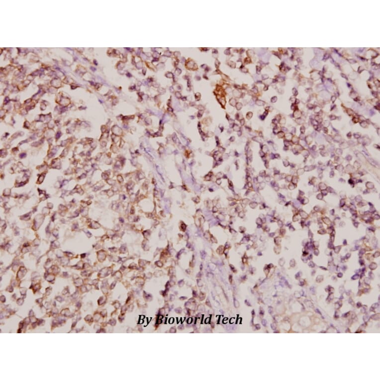 Anti-COL11A1 (G610) Antibody from Bioworld Technology (BS2182) - Antibodies.com