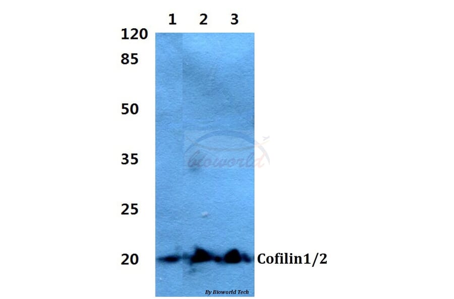 Anti-Cofilin1/2 (T88) Antibody from Bioworld Technology (BS2183) - Antibodies.com