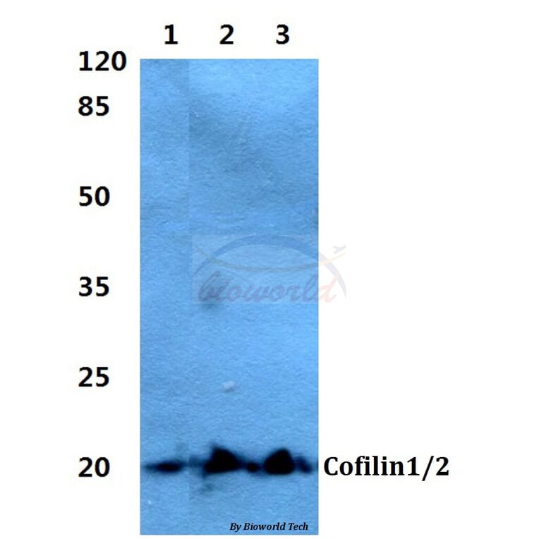 Anti-Cofilin1/2 (T88) Antibody from Bioworld Technology (BS2183) - Antibodies.com