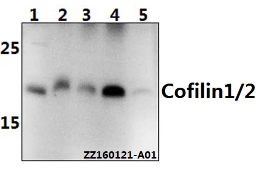 Anti-Cofilin1/2 (T88) Antibody from Bioworld Technology (BS2183) - Antibodies.com
