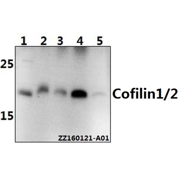 Anti-Cofilin1/2 (T88) Antibody from Bioworld Technology (BS2183) - Antibodies.com