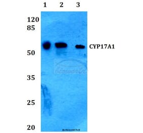 Anti-CYP17A1 (N249) Antibody from Bioworld Technology (BS2187) - Antibodies.com