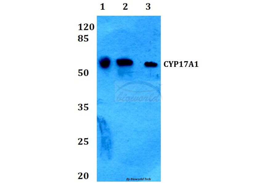 Anti-CYP17A1 (N249) Antibody from Bioworld Technology (BS2187) - Antibodies.com