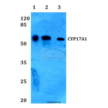 Anti-CYP17A1 (N249) Antibody from Bioworld Technology (BS2187) - Antibodies.com