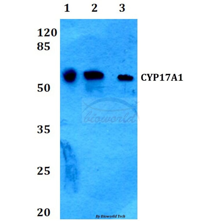 Anti-CYP17A1 (N249) Antibody from Bioworld Technology (BS2187) - Antibodies.com