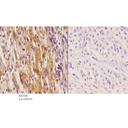 Anti-CYP1A1/2 (R98) Antibody from Bioworld Technology (BS2188) - Antibodies.com