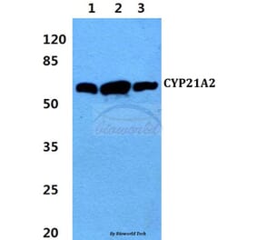 Anti-CYP21A2 (F177) Antibody from Bioworld Technology (BS2189) - Antibodies.com
