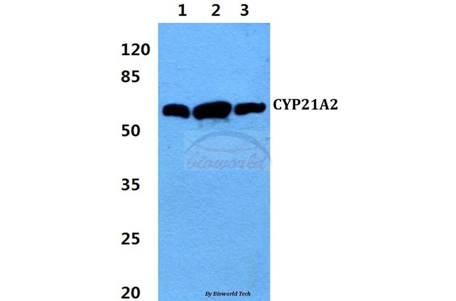Anti-CYP21A2 (F177) Antibody from Bioworld Technology (BS2189) - Antibodies.com