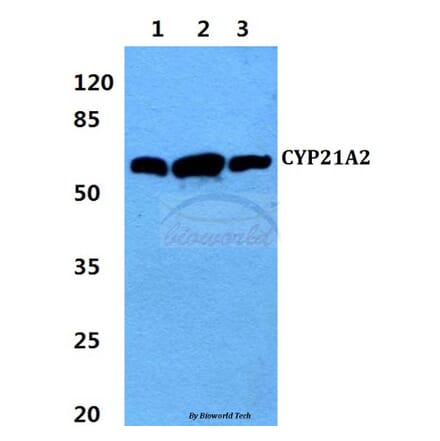 Anti-CYP21A2 (F177) Antibody from Bioworld Technology (BS2189) - Antibodies.com